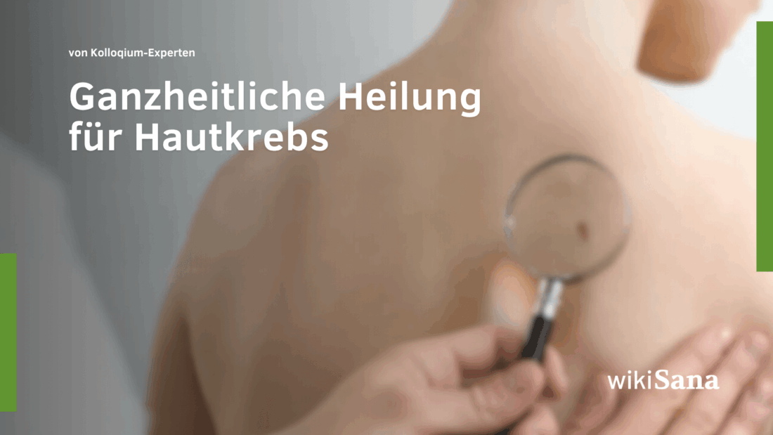 Hautkrebs Ganzheitsmedizinische Leitlinie