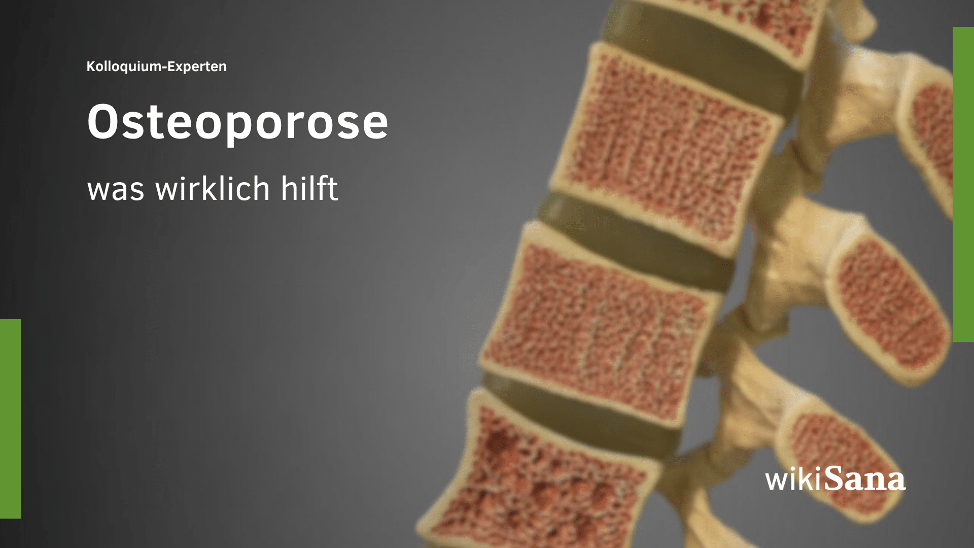 Osteoporose | Ganzheitsmedizinische Leitlinie | Teil 1/3